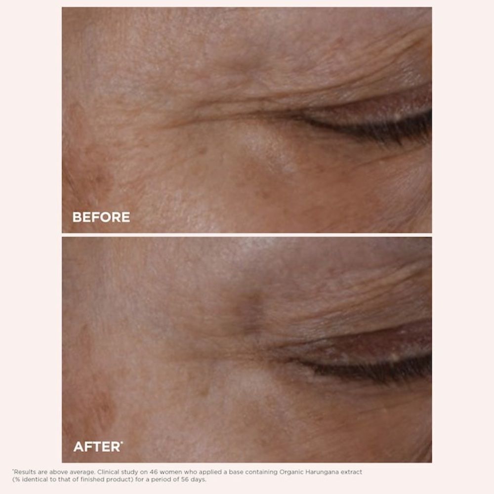 Clarins Total Eye Lift 15mL - Picture 8 of 8